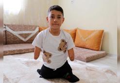Kolları ve bacakları olmadığı için evde eğitim gören Nakşin, protez istiyor