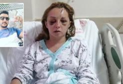 5 gün sonra yoğun bakımdan çıkan Rahime: Mezarlıkta kafama taşla vurdu
