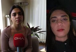 Taksicinin darbettiği Azeri Bagieva yaşadığı dehşeti anlattı