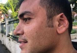 Kavgada ısırılarak kopan kulağını martı kapmıştı: Yine görsem yine müdahale ederim