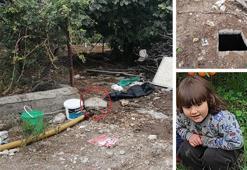 Kapağı kırık foseptiğe düşen 4 yaşındaki Naz Gül öldü