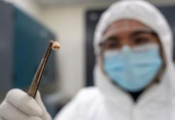 Araştırma: Kara Ölüm salgını, bağışıklık sisteminin evrimini şekillendirdi