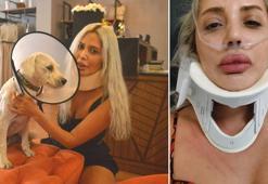 Köpek havlamasından rahatsız olduğu gerekçesiyle hayvansever kadını darbetti