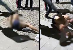 Sokakta dövülüp yüzü jiletle kesildi, ‘hırsızlıktan’ arandığı için şikayetçi olmadı