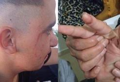 Engelli bakım merkezinde darp iddiası