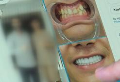 Porselen diş çılgınlığı 18 yaş altına kadar indi, diş hekimleri uyardı