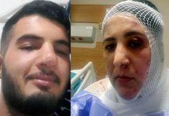 Üvey annesine kezzapla saldıran şüpheli tutuklandı