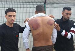 Yunan güvenlik güçlerinin darbettiği Faslı göçmen: Dövdüler, işkence ettiler