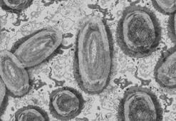AB Komisyonu, 2 milyon doz maymun çiçeği aşısı aldığını açıkladı