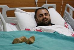 Mesanesinden toplam 550 gram ağırlığında 20 taş çıkarıldı