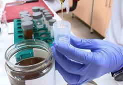 Gıda laboratuvarında analiz edilen 5 bin numuneden yüzde 10'u sorunlu çıkıyor