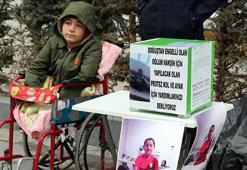 Nakşin'in tek isteği protez kol ve bacak