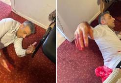 Öztürk Yılmaz’ı bıçaklayan şüpheli adliyeye sevk edildi