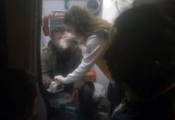 Tartıştığı mesai arkadaşının kulağını kesti