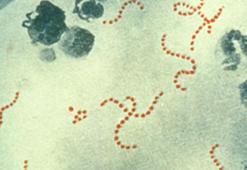 İngiltere’de Strep A’ya bağlı ölümler 122’ye ulaştı