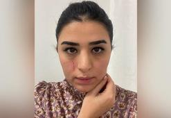 Mersin'de görev başındaki kadın doktora darp; 2 gözaltı