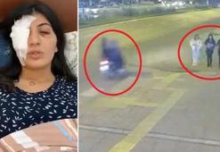 Su dolu balonla Hatice’yi gözünden yaralayan sanıklar: Şaka yaptık