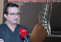 Dünyada ilk, Türk hekimler ispatladı: Tiroid hastalıkları omurga hasarına yol açıyor