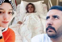 Eski nişanlısının yüzüne kimyasal atan sanık: Susturmak için yaptım