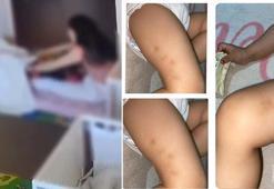 2 yaşındaki çocuğa kreşte darp; 2 görevli suçlamayı kabul etmedi