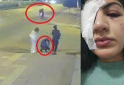 Hatice’nin su dolu balonla gözünden yaralanma davasında 'kalıcı hasar' araştırılacak