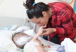 Hidrosefali hastası depremzede bebek, Antalya'da ameliyat edildi