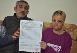 Suriye’de bomba düşen evlerinde yüzü yanan Evin, 109 ameliyat oldu