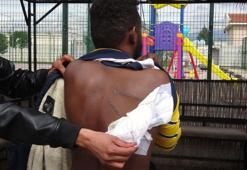 Yunan askerlerinin sırtından bıçakladığı Yemenli Abdullah'ın yaralarına 30 dikiş atıldı