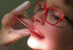Uzmanı uyardı: Çocuklarda çürüyen süt dişlerinin takibi yapılmalı