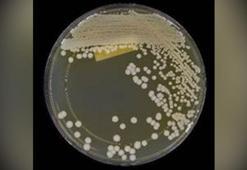 İlaca dirençli bir mantar hastalığı ABD’deki sağlık merkezlerinde yayılmaya devam ediyor