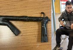 Yol kenarında bulduğu düzenek ateş aldı, bacağından yaralandı