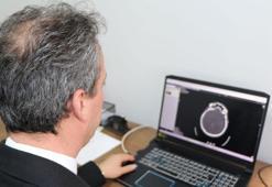 Nörolojik hastalıklara ‘yapay zeka’ ile tedavi