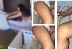 2 yaşındaki çocuğa kreşte darp iddiası davasında karar: 2 görevli beraat etti