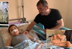 Mıknatıslı bilye yutan Miraç, ameliyatla yaşama tutundu