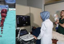 Karnından 5 kilo miyom çıkarıldı, ilk bebeğine kavuştu