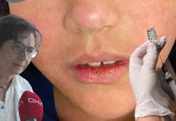 Prof. Dr. Yavuz: DSÖ verilerine göre kızamık vakalarında Avrupa ikincisiyiz, aşı kararsızlığı mutlaka giderilmeli