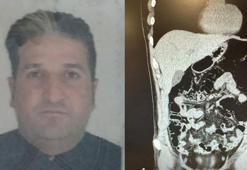 İranlı kuryenin midesinden 300 gram eroin çıktı