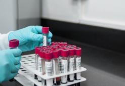 İngiltere’de bulaşıcı cinsel hastalıklar rekor seviyeye yükseldi