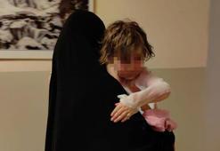 Üzerine kaynar su dökülen 4 yaşındaki Abir yaralandı