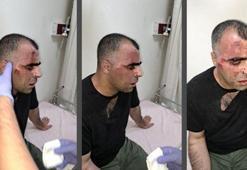 Belediye çalışanı gazeteciyi darbetti, polis memuru da araya girmek isteyenleri engelledi; o anlar kamerada