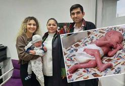 ‘Yılan bebek’ Gökdeniz’in babasının 'soybağının reddi' davasına 2,5 yıl sonra ret