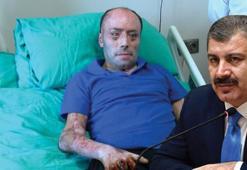 Bakan Koca: Tedavisi bayram dönüşü devam edecek