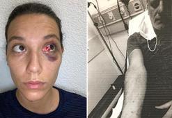 Deniz Bulutsuz ve Ozan Güven davasında rapor bekleniyor