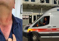 Kendisini geç fark eden ambulansın şoförünü darbetti