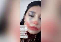 15 yaşında evlendirilmek istenen kız çocuğu koruma altına alındı