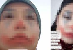 15 yaşındaki kızın evlendirileceği damat adayı tutuklandı, anne ve babalar serbest bırakıldı