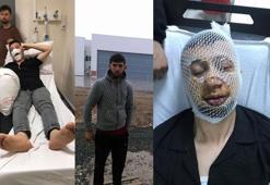 Samsun'da maganda kurşunu ile biri çocuk 3 kişi yaralandı