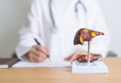 "Siroz tedavisi kişiye özeldir, ihmal edilmemelidir"