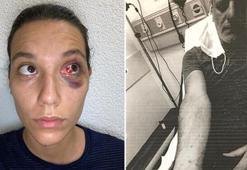 Deniz Bulutsuz ve Ozan Güven davasında adli tıp raporu mahkemeye ulaştı