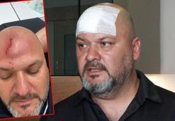 100 bin lira kira talebini reddeden kiracıya beyzbol sopalı saldırı iddiası